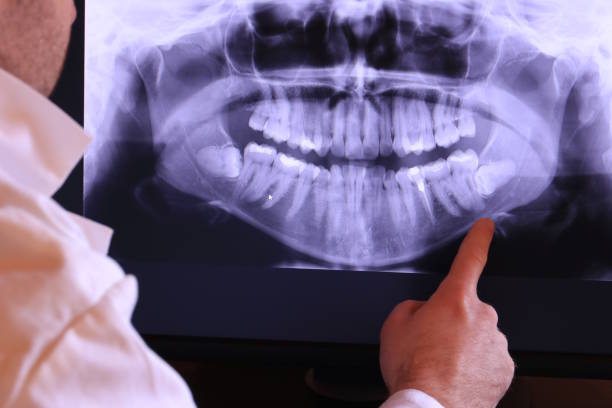 Best Broken Tooth Emergency  in Apple Valley, CA